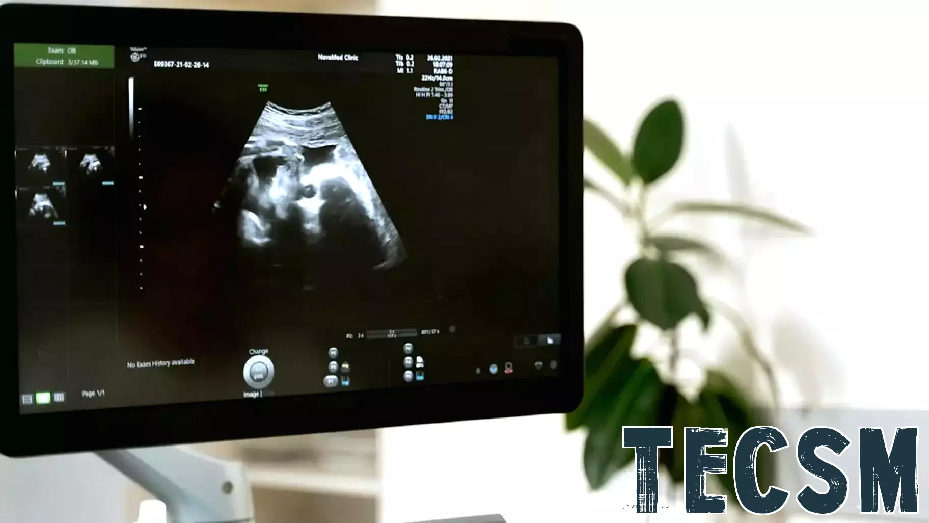 Exploring the Role of Ultrasound in Medical Imaging