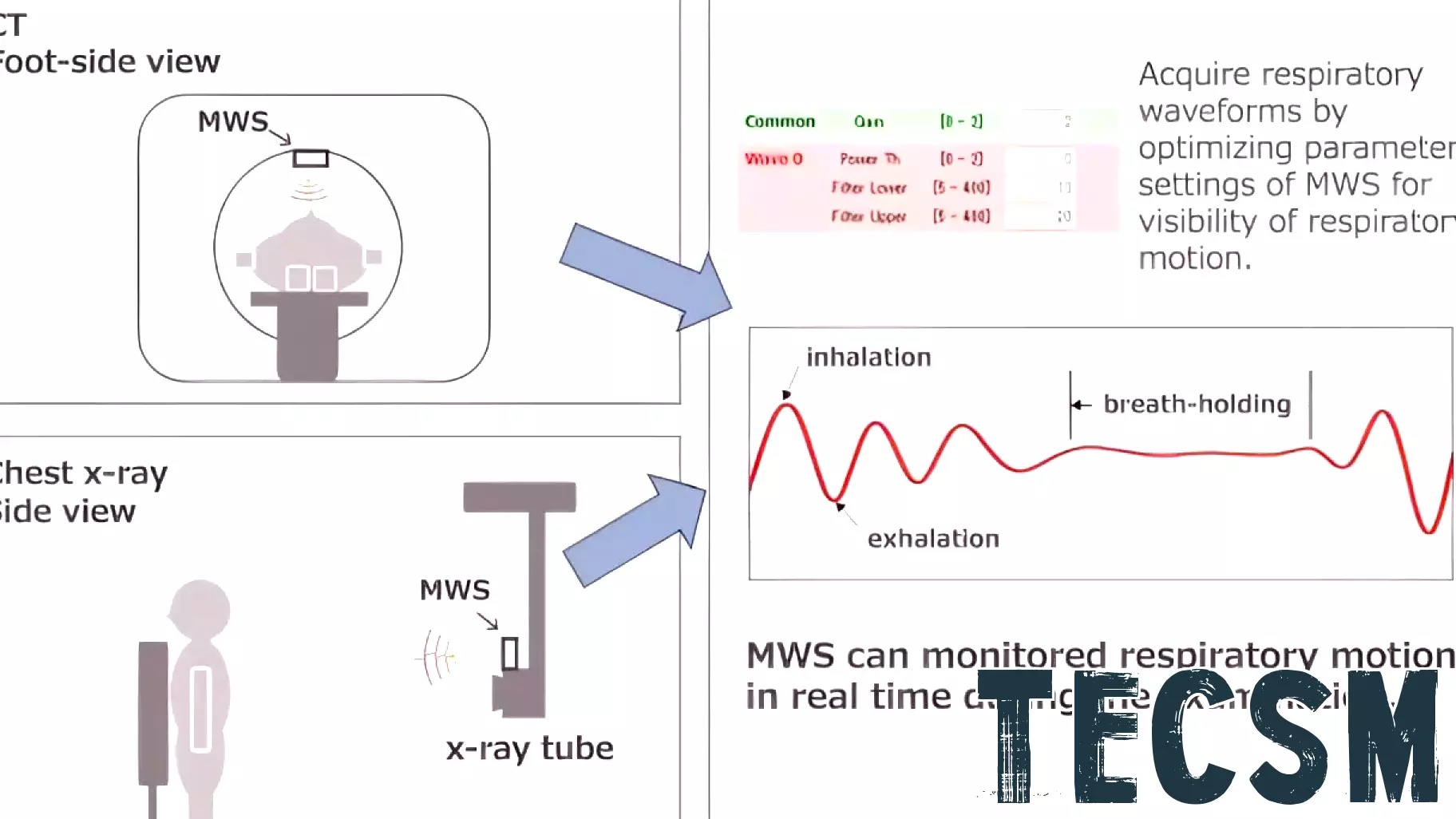 Innovative Sensor Technology Enhances Precision in Medical Imaging