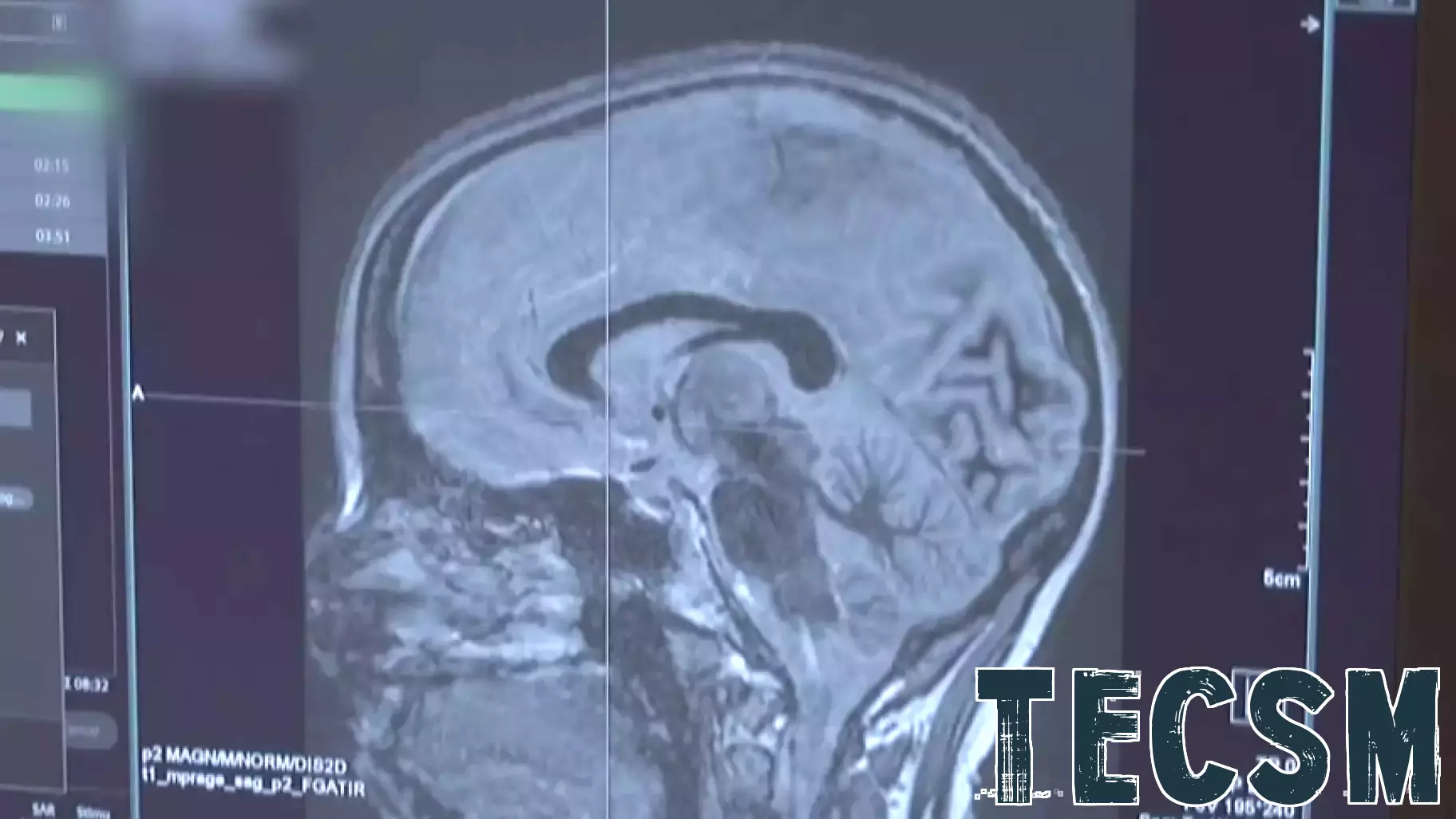 New technology offers hope for Parkinson’s patients