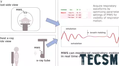 Innovative Sensor Technology Enhances Precision in Medical Imaging